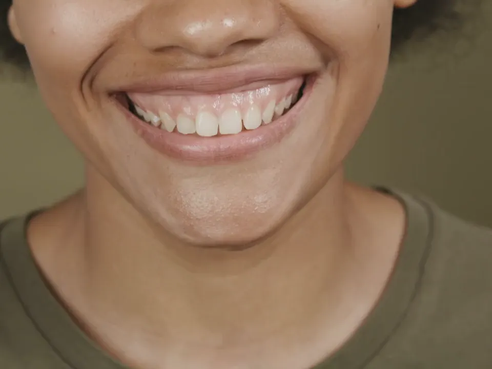 Primer plano de una sonrisa natural